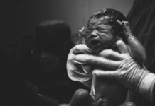 QUIZ – Profilaxia na Doença Hemolítica Perinatal, quando fazer? doença hemolítica perinatal