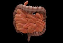 QUIZ – Qual a principal causa de Isquemia Intestinal Aguda? Isquemia Intestinal Aguda Supercrescimento Bacteriano no Intestino Delgado