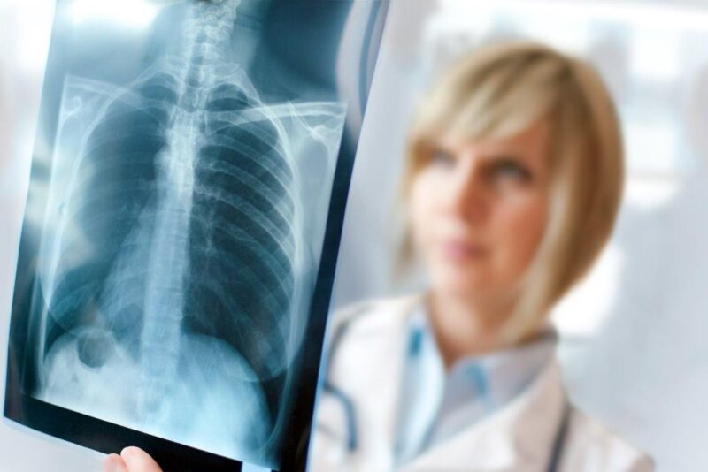 Profissional de saúde analisando exame pulmonar em paciente com hantavirose