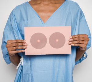 cancer de mama em mulheres negras tnbc
