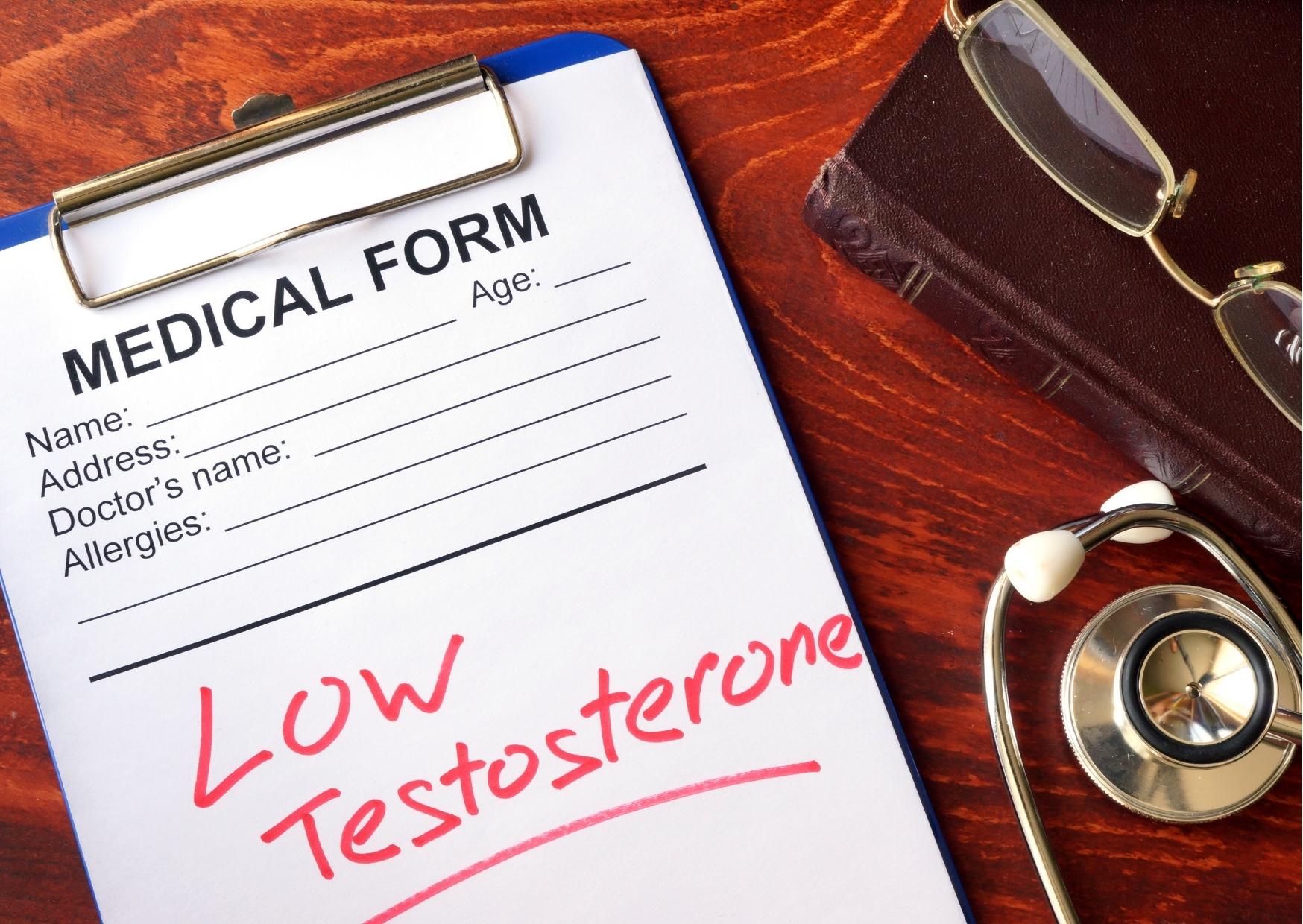testosterona covid 19 hipogonadismo durateston