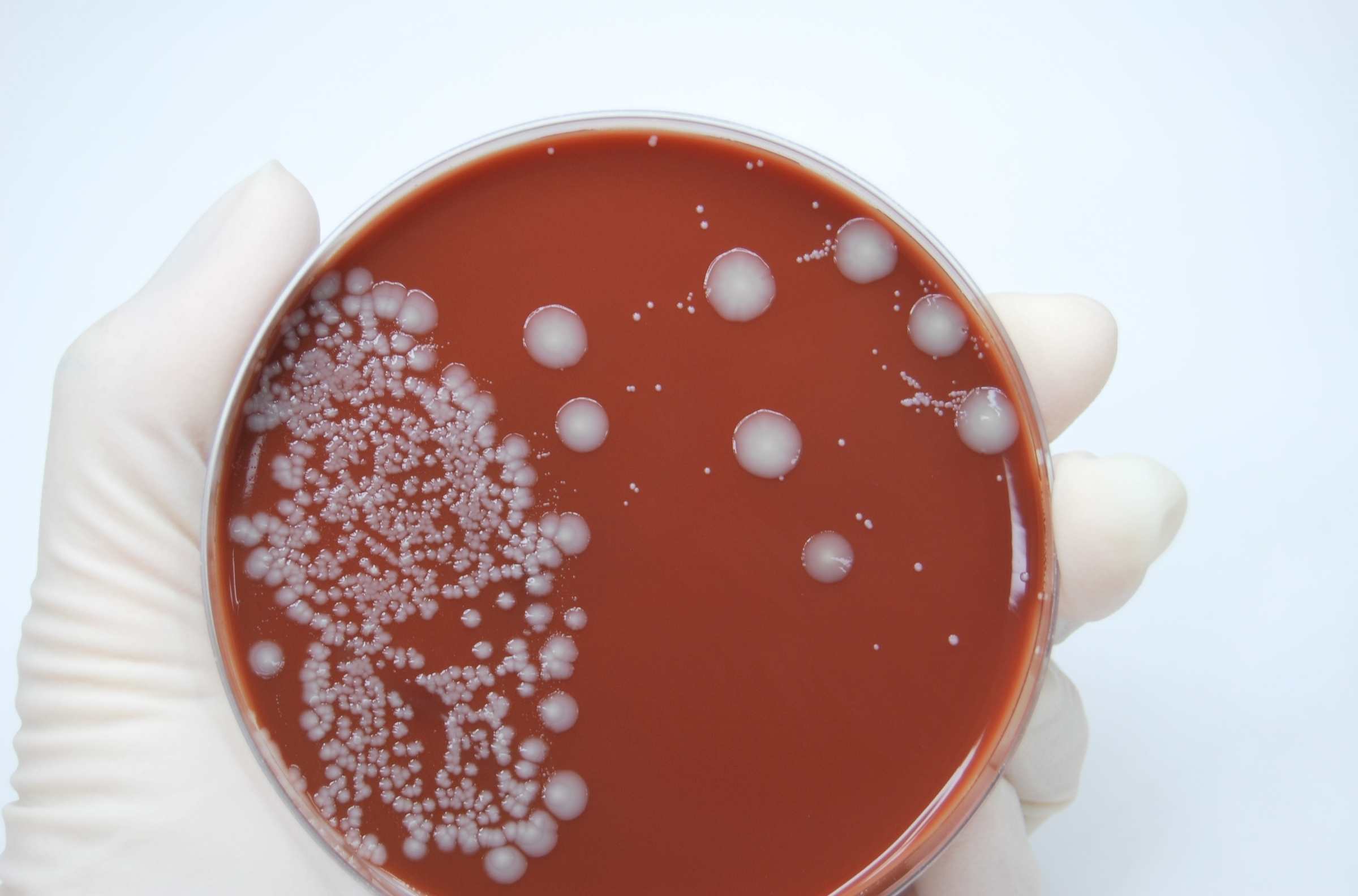e. coli cancer