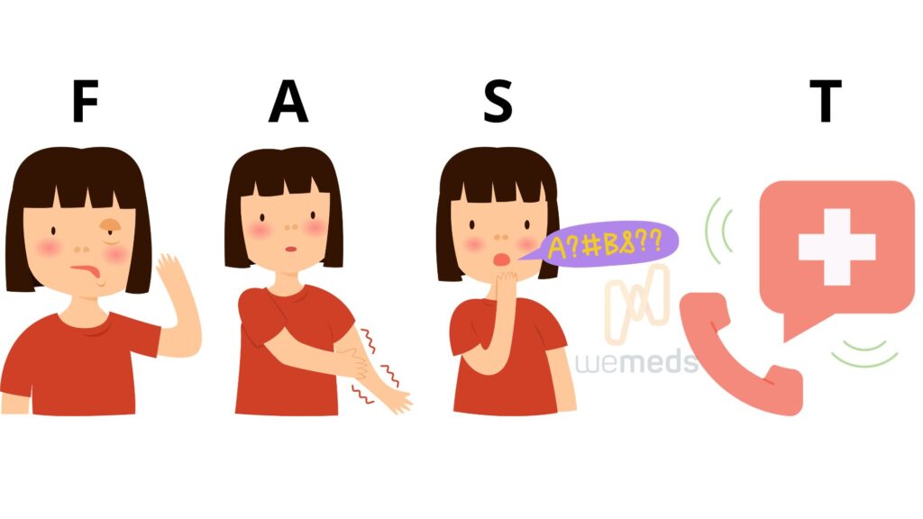 Método FAST para reconhecer sinais de AVC rapidamente