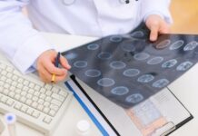 Escala de Fisher na hemorragia subaracnoidea: classificação, interpretação e Fisher modificada médico avaliando resultado de TC de crânio para uso da escala de Fisher na hemorragia subaracnoidea