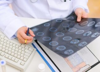 Escala de Fisher na hemorragia subaracnoidea: classificação, interpretação e Fisher modificada médico avaliando resultado de TC de crânio para uso da escala de Fisher na hemorragia subaracnoidea