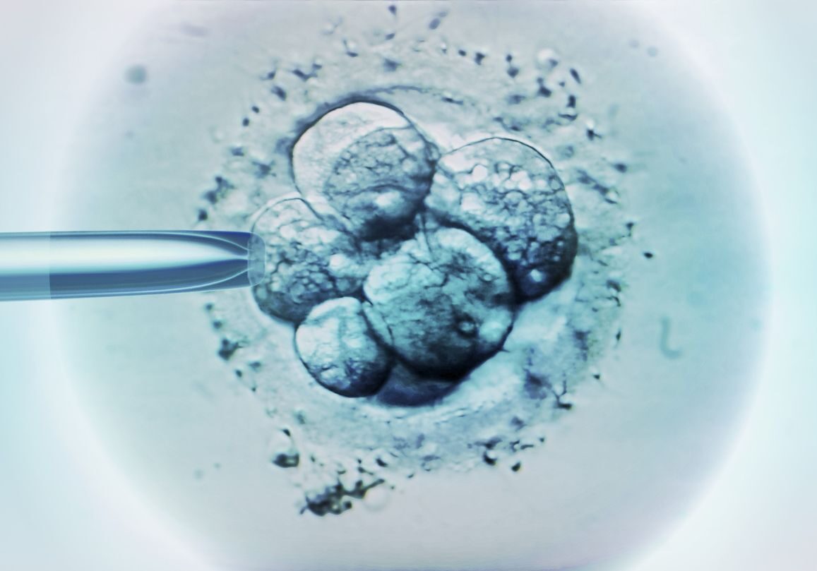 embrião sintético fiv 