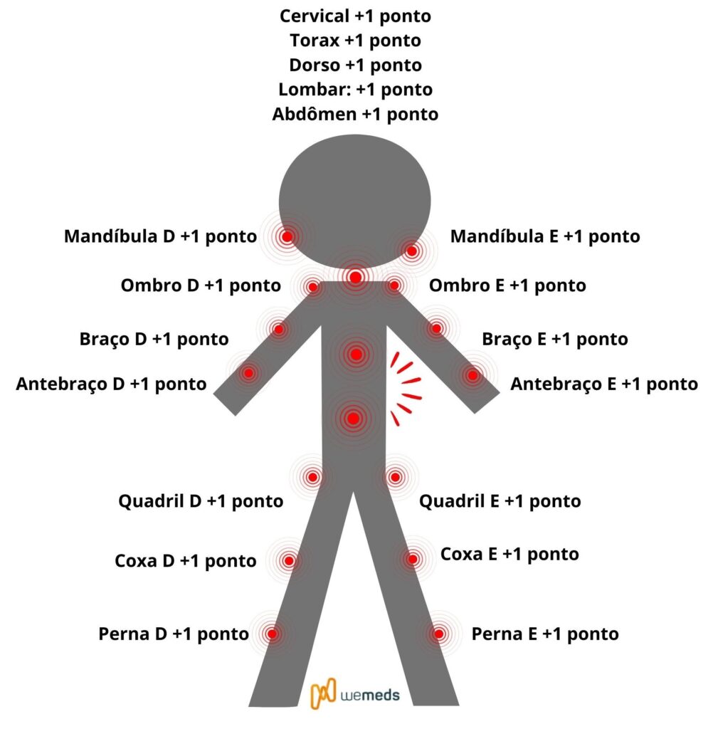 fibromialgia criterios