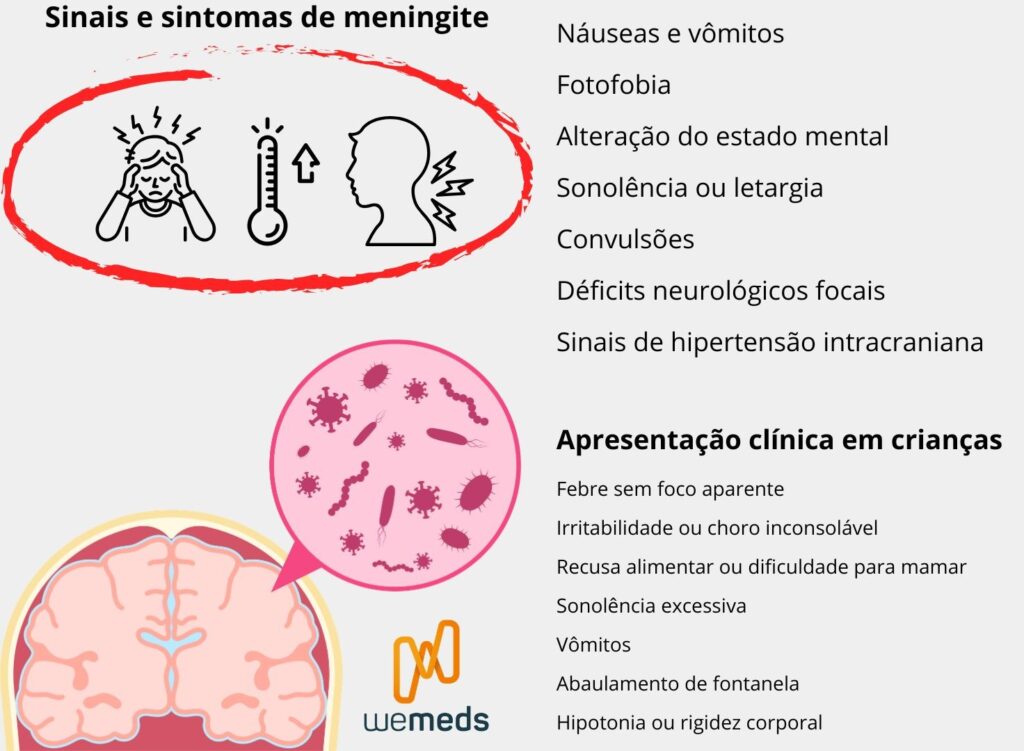 representação dos sinais e sintomas da meningite, incluindo a tríade clássica e a apresentação clínica em crianças