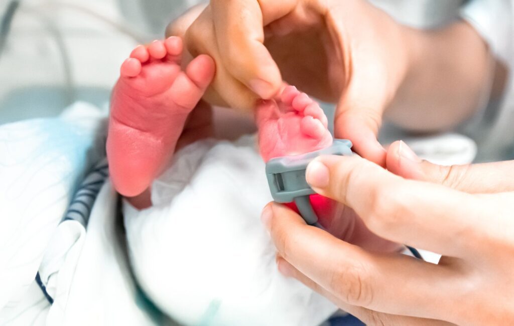 neonato em unidade de terapia intensiva sendo avaliado quanto a síndrome de abstinência neonatal