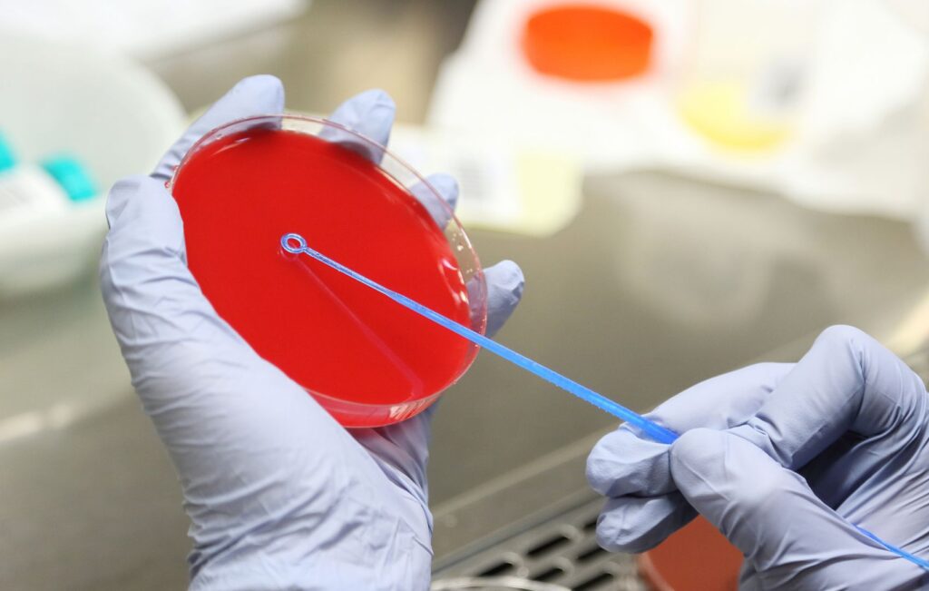 representação da hemocultura realizada em laboratório que pode auxiliar no diagnóstico da angina de ludwig
