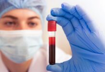 Exame VHS: velocidade de hemossedimentação, valores de referência e quando está alta Profissional de laboratório analisando um tubo de amostra de sangue, representando o exame de velocidade de hemossedimentação (VHS).