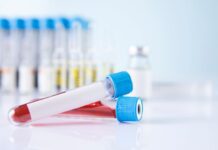 D-dímero: guia prático para interpretar sem cair em armadilhas Tubos de coleta de sangue com tampa azul usados para análise de coagulação e D-dímero