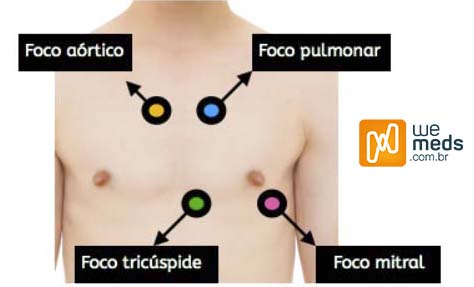 IC ausculta cardiaca