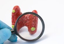Paricalcitol: dose, monitorização e principais cuidados na DRC médico segurando uma lupa com destaque para as glândulas paratireoides, que produzem paratormônio (PTH)