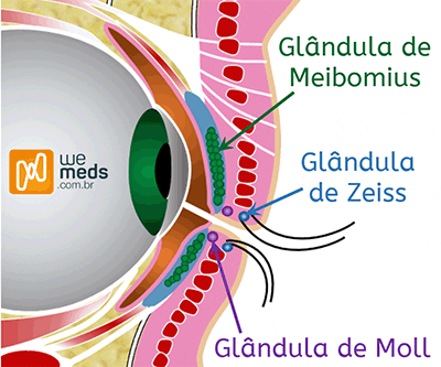 Terçolho/ Hordéolo - Clínica Privada de Oftalmologia