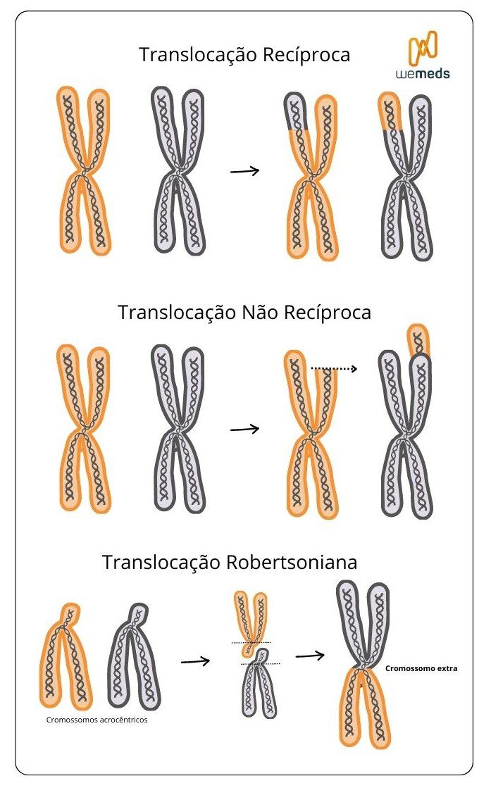 trissomias cromossômicas translocação