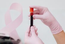 CA 15-3: indicações, limitações e interpretação no câncer de mama tubo de sangue coletado representando exame de CA 15-3 no câncer de mama