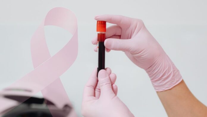 exame de sangue outubro rosa cancer de mama tubo de sangue coletado representando exame de CA 15-3 no câncer de mama