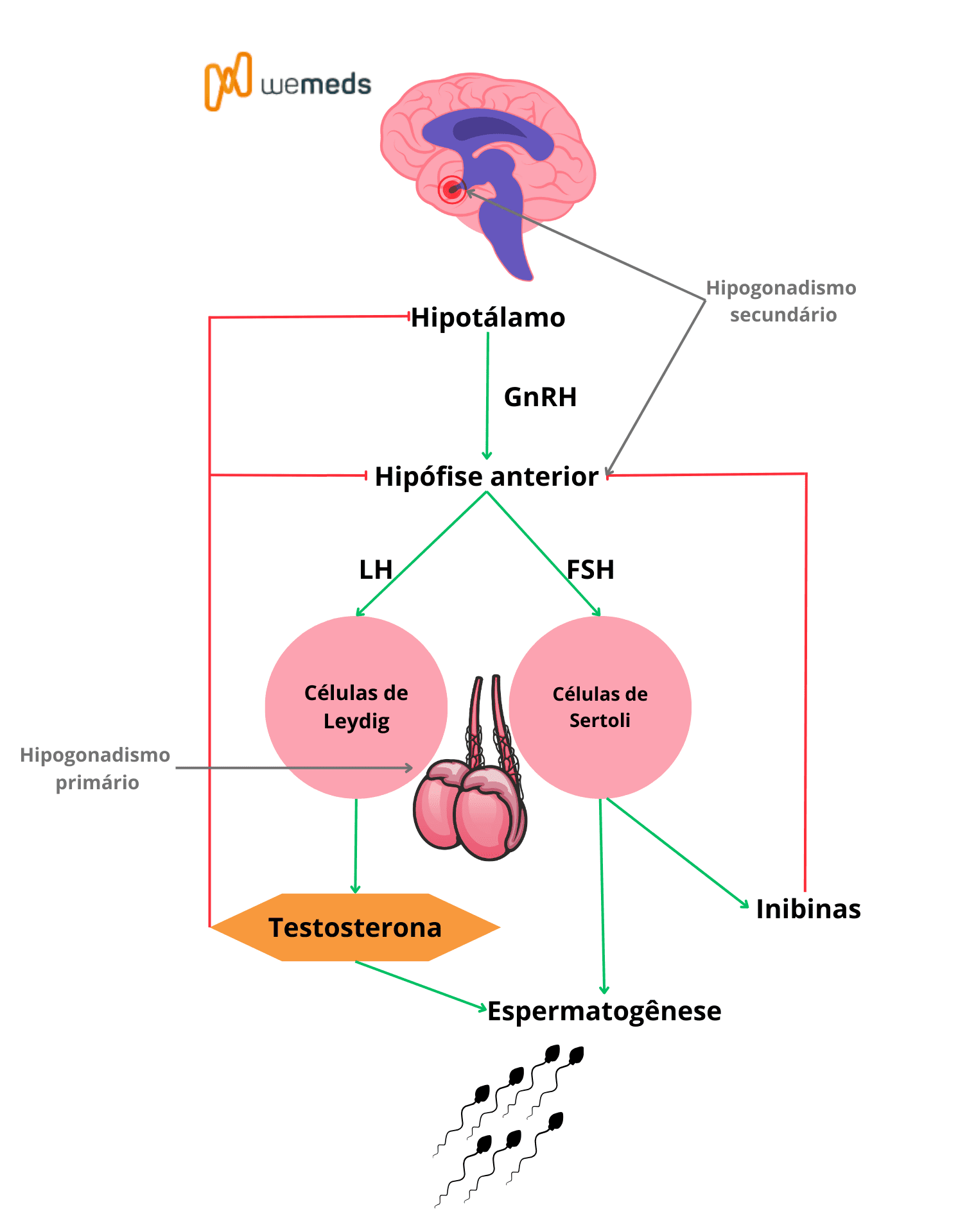 hipogonadismo masculino