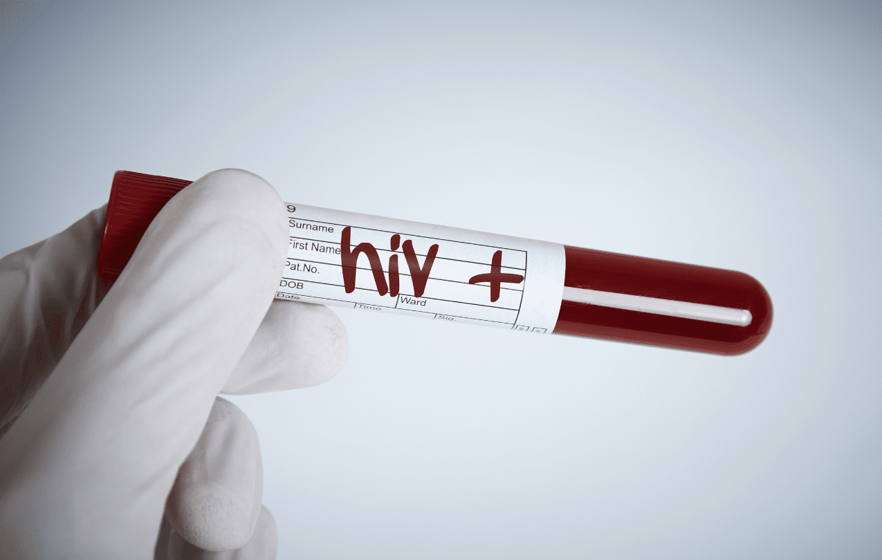 acidente com perfurocortante amostra de sangue hiv