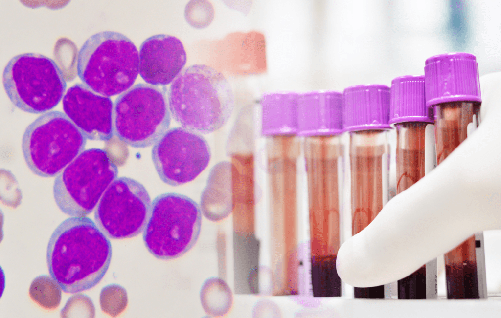 imagem representativa de células leucêmicas associada a tubos de coleta de sangue