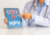 Teste molecular para HPV foi incorporado no SUS hpv rastreamento do câncer do colo do útero, DNA-HPV