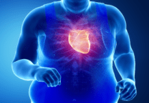 Síndrome CKM: o que muda com a nova diretriz de 2026? imagem de coração destacado em paciente obeso, representando a síndrome CKM (síndrome cardiovascular renal metabólica)