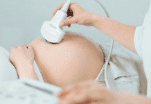 Acretismo placentário: complicação grave pode causar hemorragia no parto Acretismo placentário durante gestação com avaliação por ultrassom obstétrico