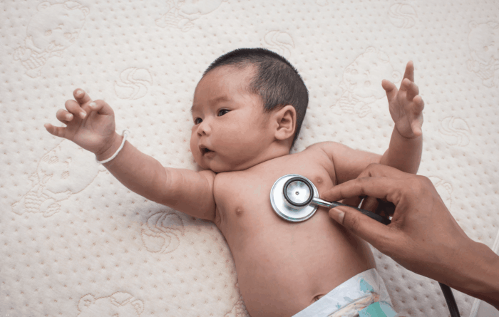 Recém-nascido sendo avaliado clinicamente pela Escala de Finnegan quanto a síndrome de abstinência neonatal