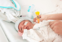 Escala de Finnegan na Síndrome de Abstinência Neonatal Recém-nascido sendo avaliado pela Escala de Finnegan quanto a síndrome de abstinência neonatal