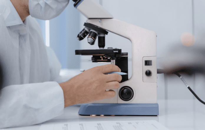 Cystoisospora belli, Cistoisosporíase