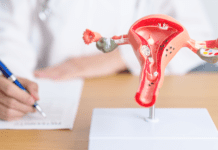 Endometriose: por que o diagnóstico demora tantos anos? representação de um útero na mesa do ginecologista, estudando os sinais mais comuns da endometriose