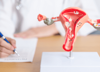Endometriose: por que o diagnóstico demora tantos anos? representação de um útero na mesa do ginecologista, estudando os sinais mais comuns da endometriose
