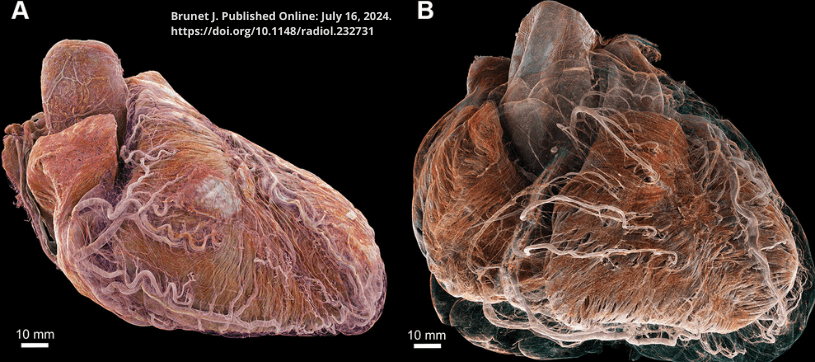 HEART ATLAS