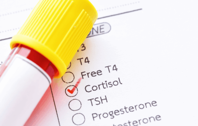 exame de sangue para coleta de cortisol basal utilizado no diagnóstico de insuficiência adrenal