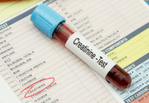 Creatinina: como interpretar corretamente e evitar erros comuns exame de creatinina