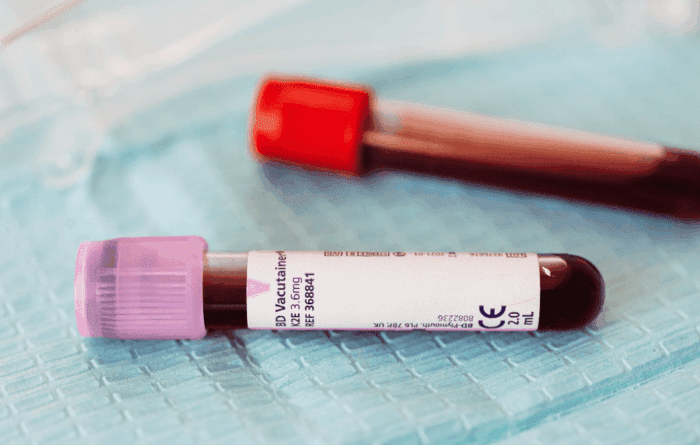 Tubos de coleta de sangue sobre laudo laboratorial utilizado para dosagem de DHEA-S e avaliação da função adrenal