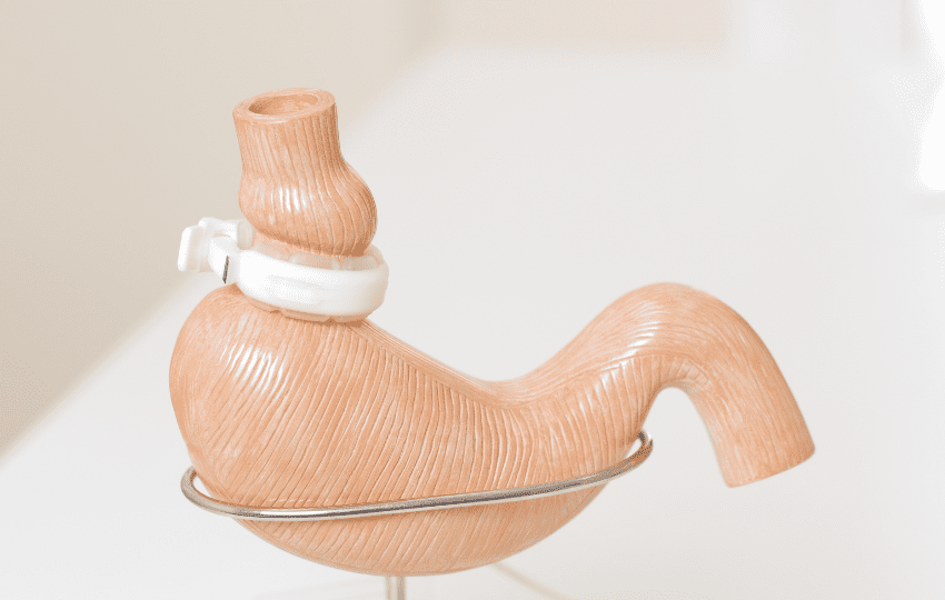 cirurgia bariatrica