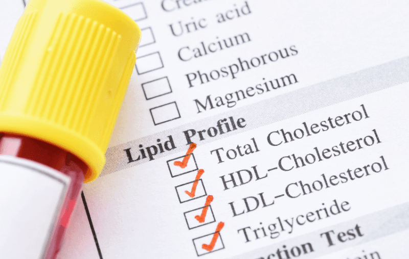 tubo de exame para avaliação de colesterol total, colesterol HDL e colesterol LDL