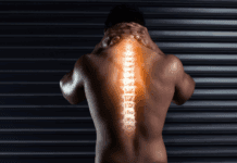 Choque neurogênico: principais causas, sinais clínicos e tratamento Síndrome de Compressão Medular