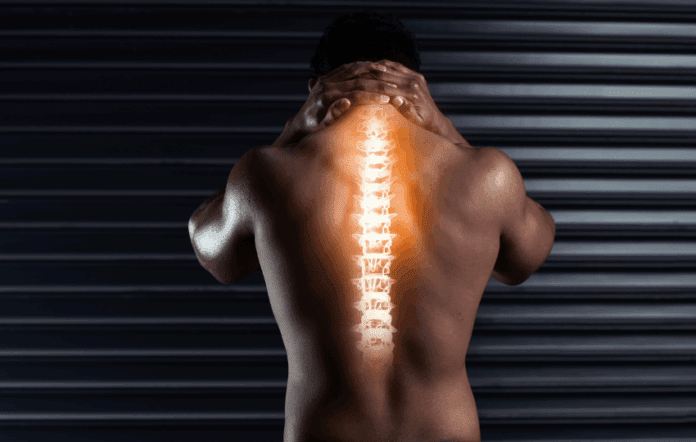 Síndrome de Compressão Medular