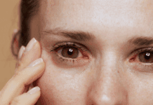 Síndrome de Sjögren: da autoimunidade glandular à vigilância linfoproliferativa síndrome de sjögren