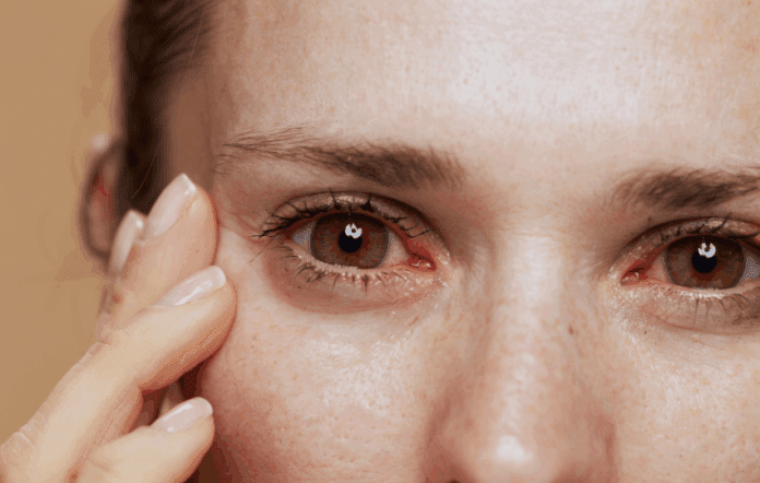 síndrome de sjögren