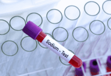 Hiponatremia: o que é, sintomas, causas e como tratar