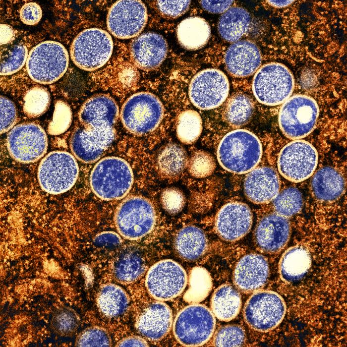 Imagem de microscopia eletrônica do vírus mpox em célula infectada (NIAID)