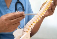 Polilaminina para lesão medular funciona? Veja o que mostram os estudos médico apontando para uma coluna vertebral, foco do uso da polilaminina na lesão medular