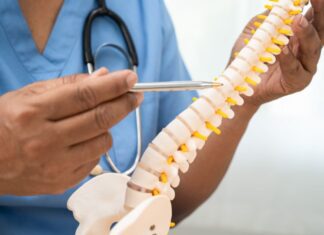 Polilaminina para lesão medular funciona? Veja o que mostram os estudos médico apontando para uma coluna vertebral, foco do uso da polilaminina na lesão medular