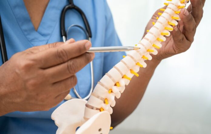 médico apontando para uma coluna vertebral, foco do uso da polilaminina na lesão medular