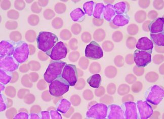 SUS incorpora venetoclax + azacitidina para leucemia mieloide aguda A sua dose diária de medicina