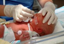 Reanimação neonatal: algoritmo atualizado da SBP recém-nascido em UTI neonatal sendo avaliado quando a necessidade de reanimação neonatal pelo algoritmo atualizado da SBP